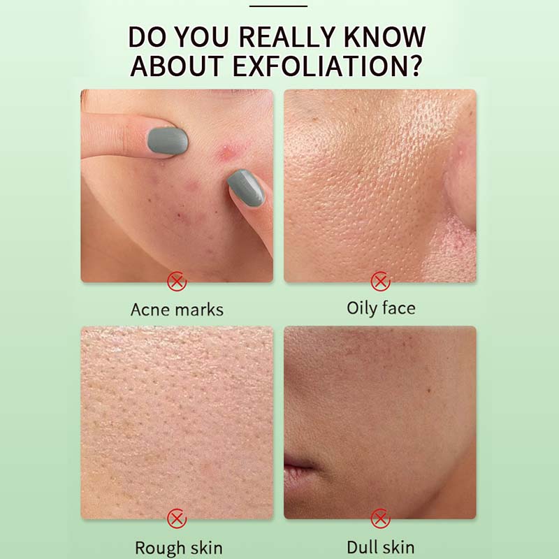 🌸 Clear Oil Control Peeling-Gel 🌸-Sanfte Reinigung · Tiefenregeneration · Feuchtigkeitspflege