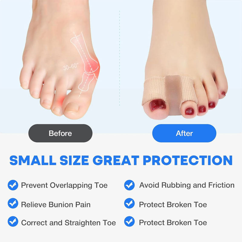 Zehenseparator & Hallux valgus-Korrektur🦶