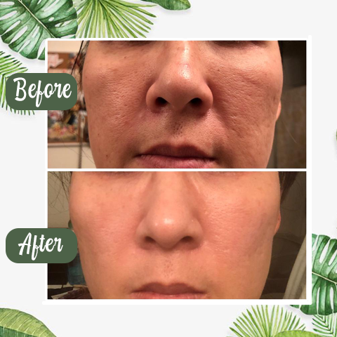 Hot Sale - Deep Cleanse Grüner Tee Maske