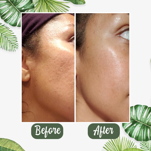Hot Sale - Deep Cleanse Grüner Tee Maske