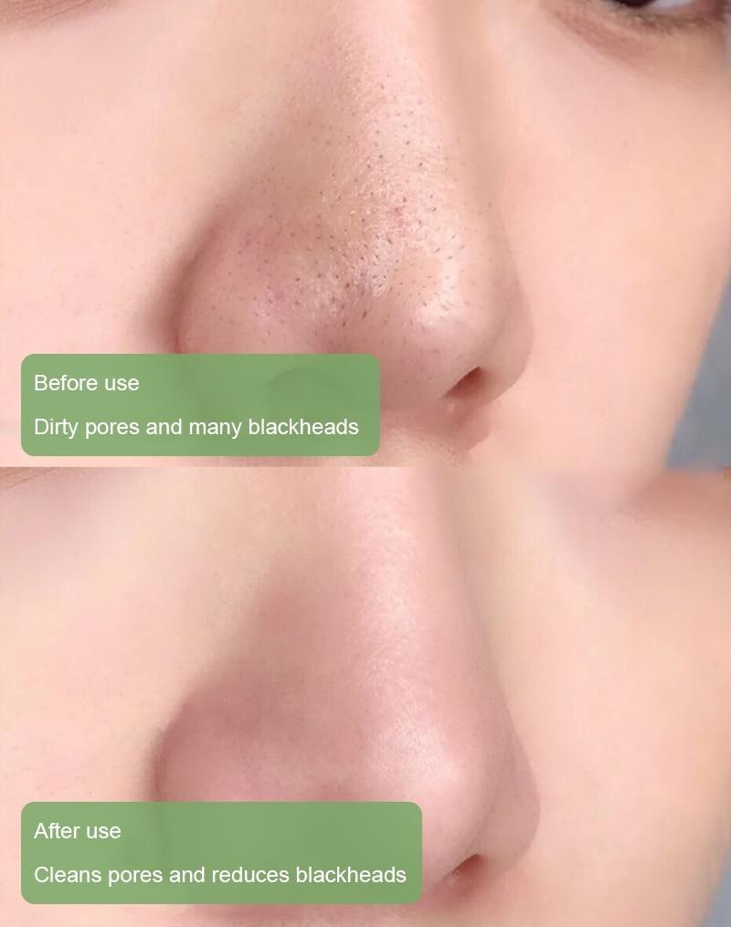 Hot Sale - Deep Cleanse Grüner Tee Maske